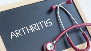 Arthritis illustration